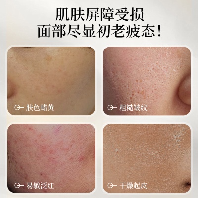 nak补水保湿控油紧致面霜一件代发精华液爽肤水一件起批护肤套装