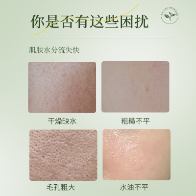 慕美皙茶树纯露喷雾面部护理控油滋润淡闭口爽肤水男女护肤品批发